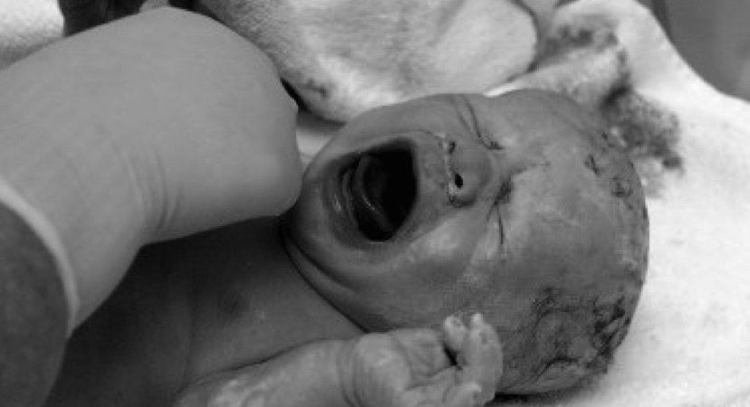 Carol Gray Tells the Truth About Epidurals at MamaSpace Yoga