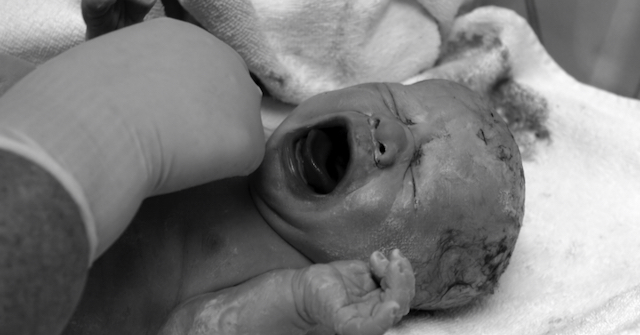 A black and white photo of a newborn crying in pain