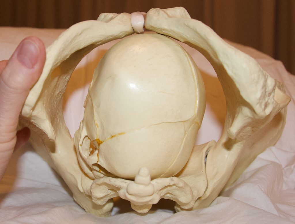 Carol Gray demonstrating a less than ideal Position for Baby's Birth using a plastic baby skull and pelvis model
