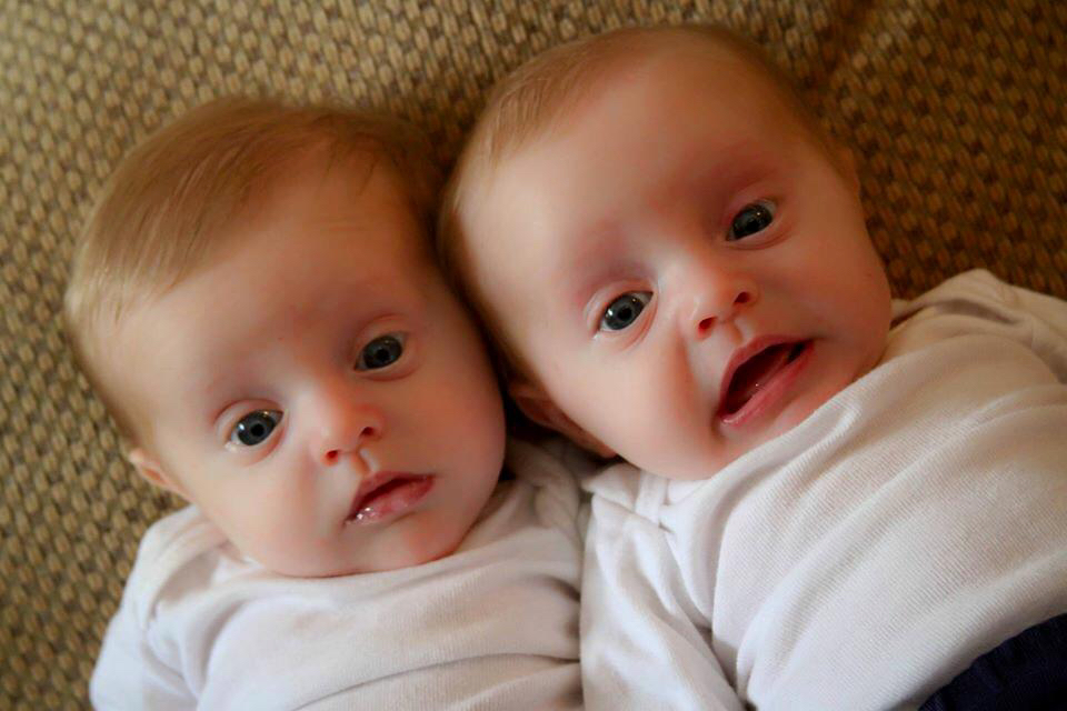 A photo of identocal twins at three months