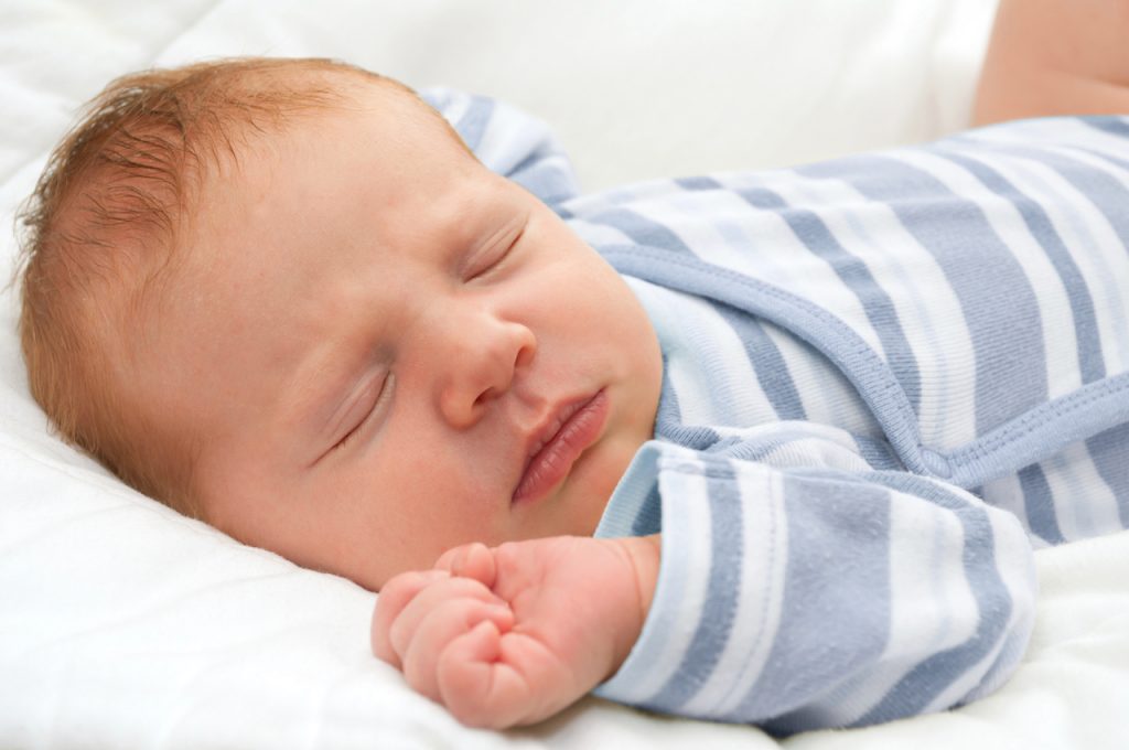 A photo of a baby who has Torticollis 