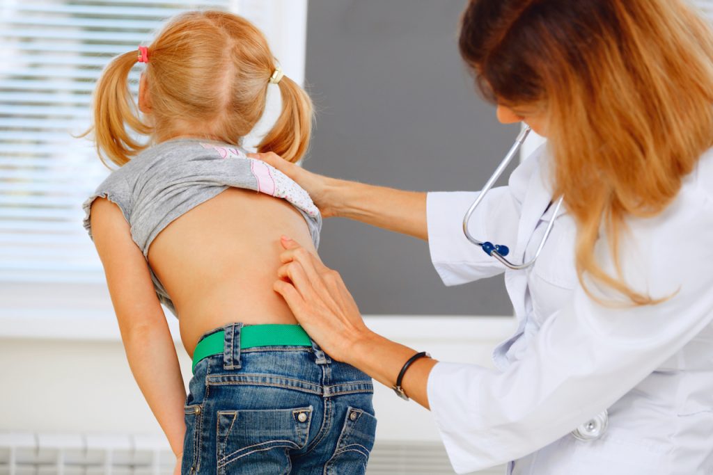 A doctor checking a school aged child for scoliosis