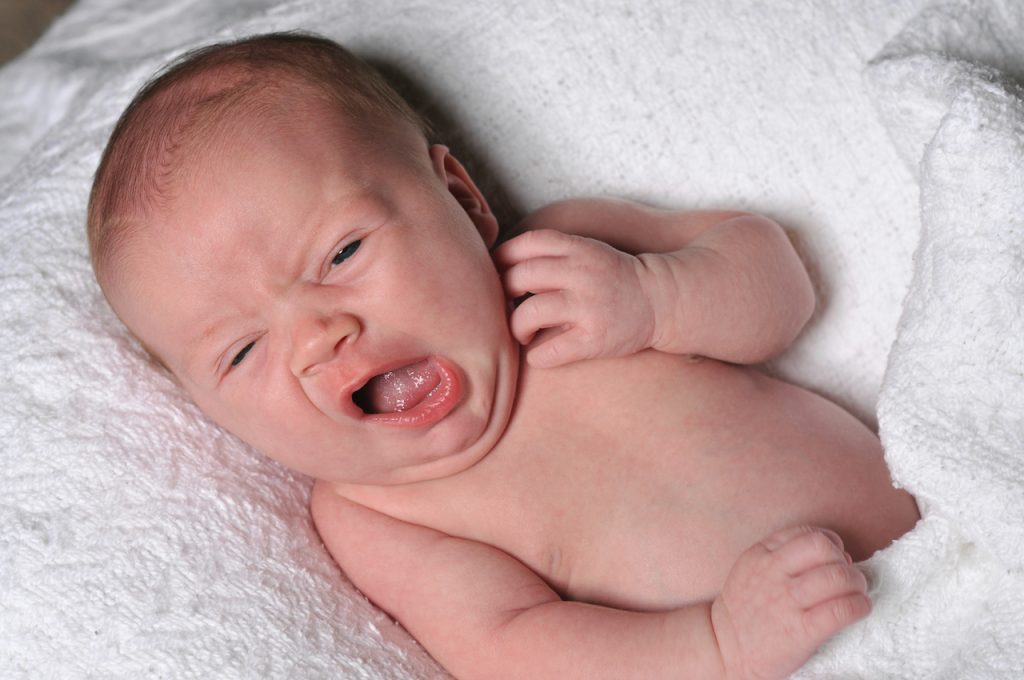 A photo of a baby who has asymmetrical features