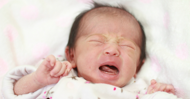 A photo of a crying baby who has asymmnetrical tongue movements